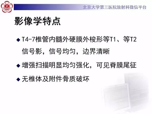 【病例】脊柱原发性硬膜外淋巴瘤1例MR