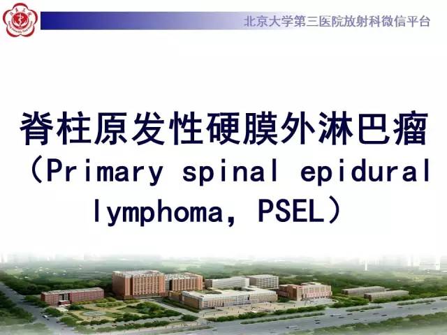 【病例】脊柱原发性硬膜外淋巴瘤1例MR