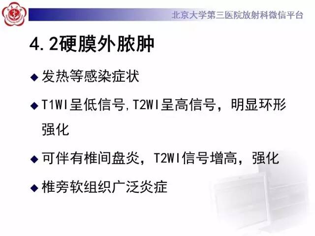【病例】脊柱原发性硬膜外淋巴瘤1例MR
