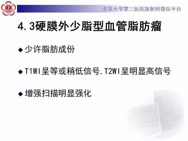 【病例】脊柱原发性硬膜外淋巴瘤1例MR