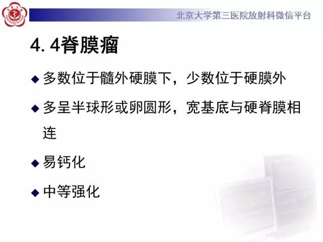 【病例】脊柱原发性硬膜外淋巴瘤1例MR