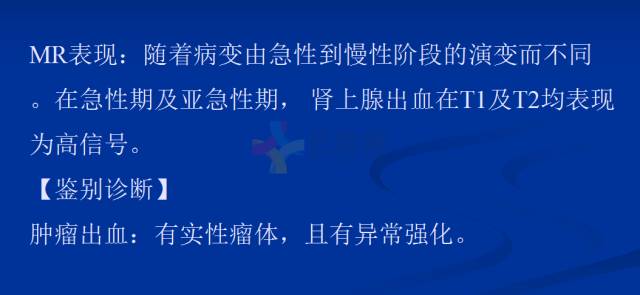 【PPT】肾上腺疾病影像诊断