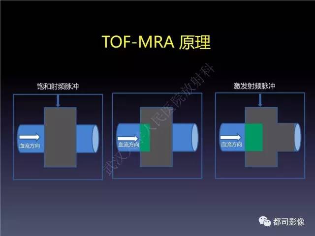 【PPT】颅内动脉粥样硬化高分辨MRI与临床