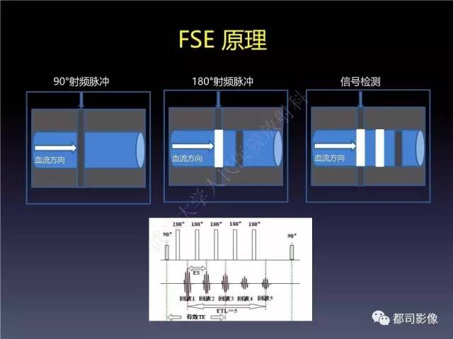 【PPT】颅内动脉粥样硬化高分辨MRI与临床