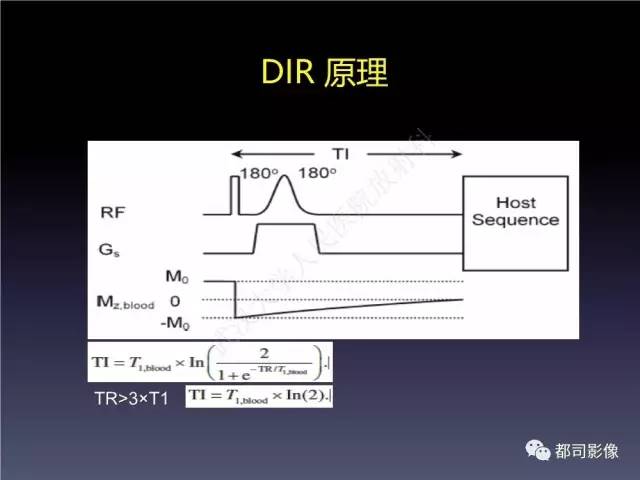 【PPT】颅内动脉粥样硬化高分辨MRI与临床