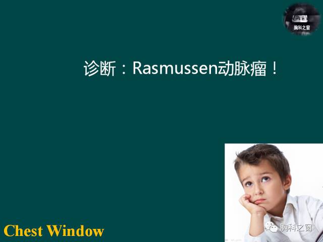 【PPT】肺结核假性动脉瘤