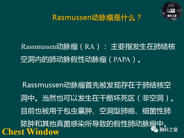 【PPT】肺结核假性动脉瘤