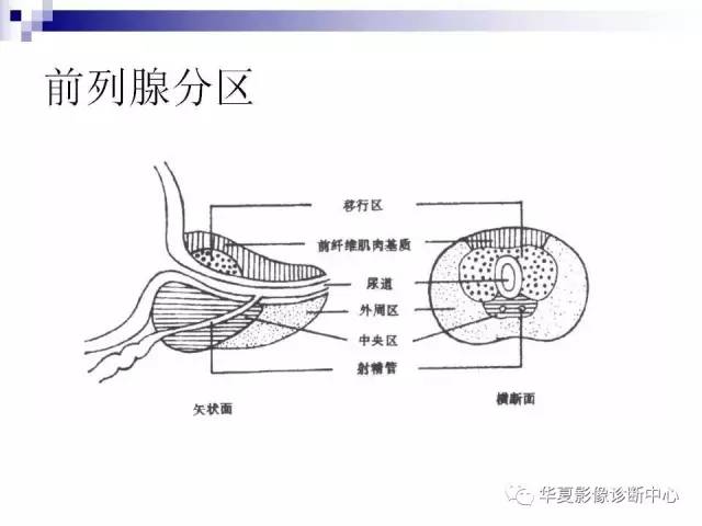 【PPT】前列腺癌的MRI诊断