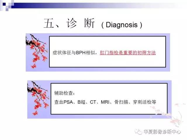 【PPT】前列腺癌的MRI诊断