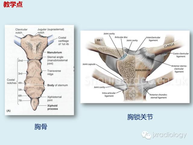 【PPT】胸骨及胸锁关节病变【RG精选】