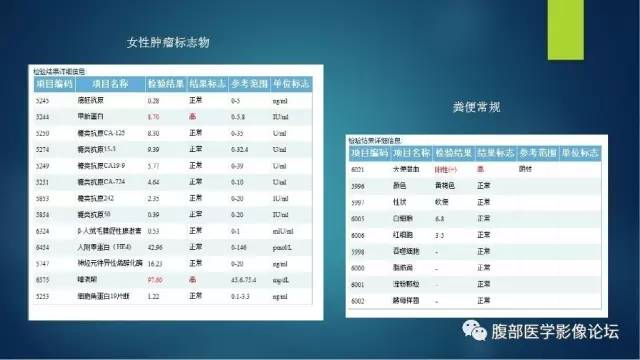 【病例】右肾透明细胞癌伴钙化1例CT及MR