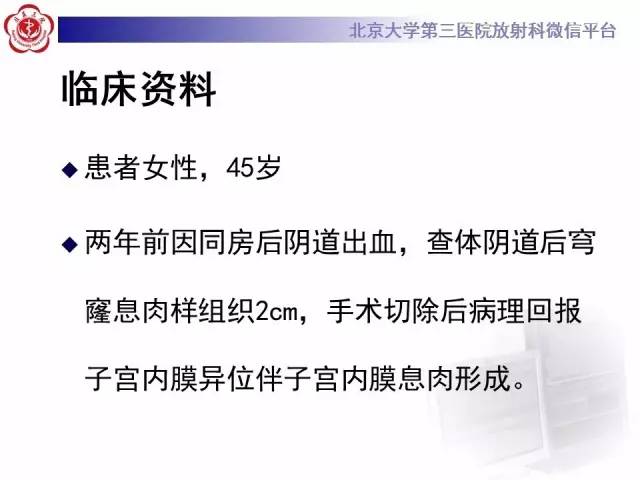 【病例】宫颈子宫内膜异位症(深部浸润型)1例MR