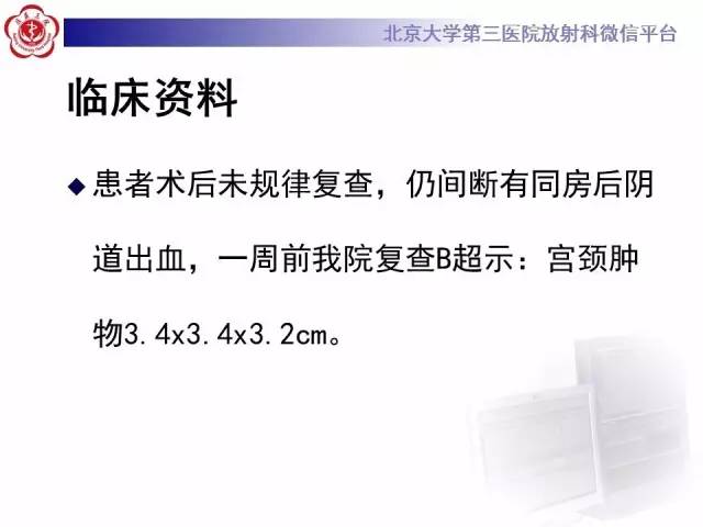 【病例】宫颈子宫内膜异位症(深部浸润型)1例MR