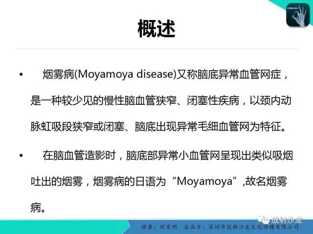 【PPT】浅析烟雾病的影像诊断