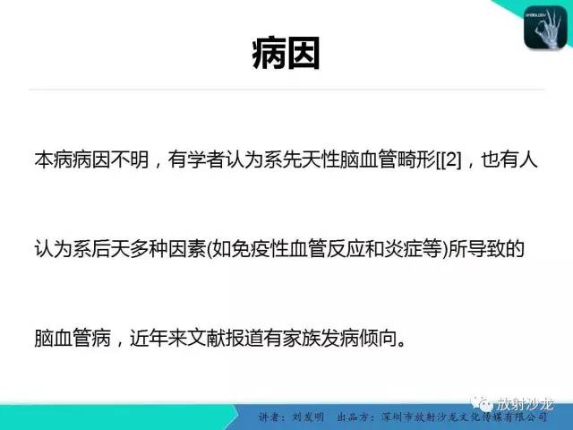 【PPT】浅析烟雾病的影像诊断