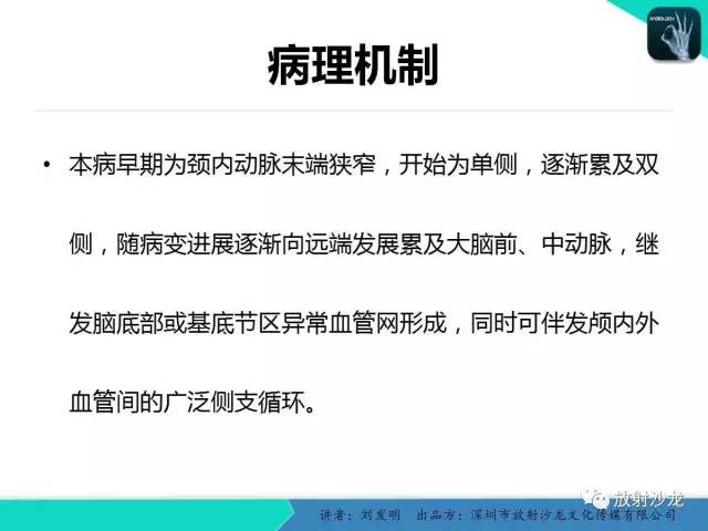 【PPT】浅析烟雾病的影像诊断