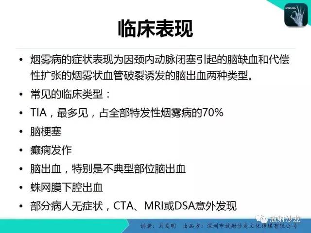 【PPT】浅析烟雾病的影像诊断