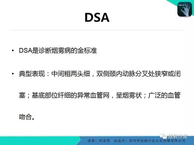 【PPT】浅析烟雾病的影像诊断