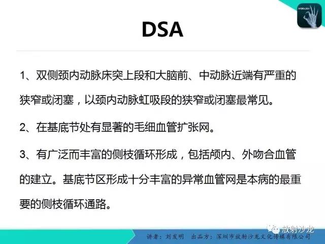 【PPT】浅析烟雾病的影像诊断