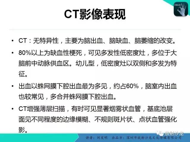 【PPT】浅析烟雾病的影像诊断