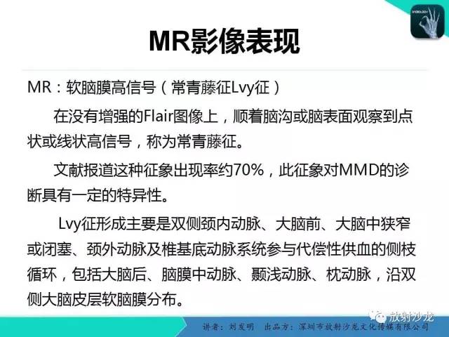 【PPT】浅析烟雾病的影像诊断