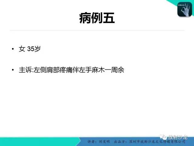 【PPT】浅析烟雾病的影像诊断