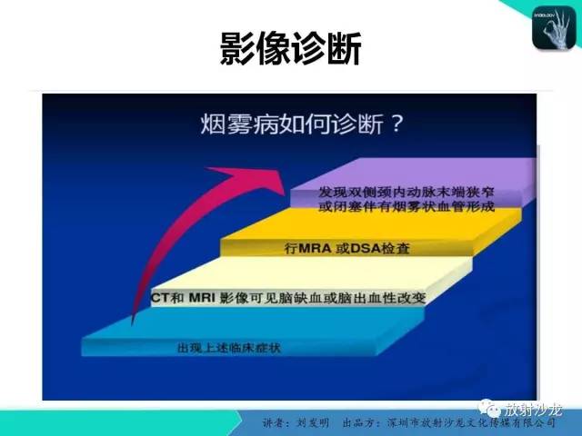 【PPT】浅析烟雾病的影像诊断