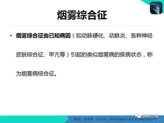 【PPT】浅析烟雾病的影像诊断
