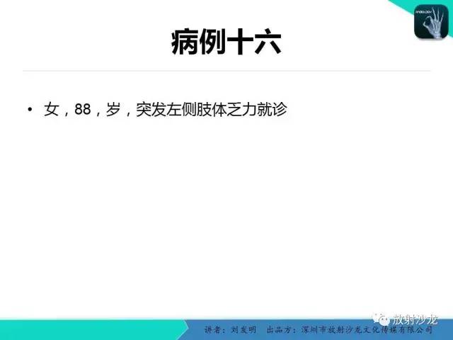【PPT】浅析烟雾病的影像诊断