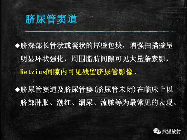 【PPT】脐尿管畸形与脐尿管癌的CT表现