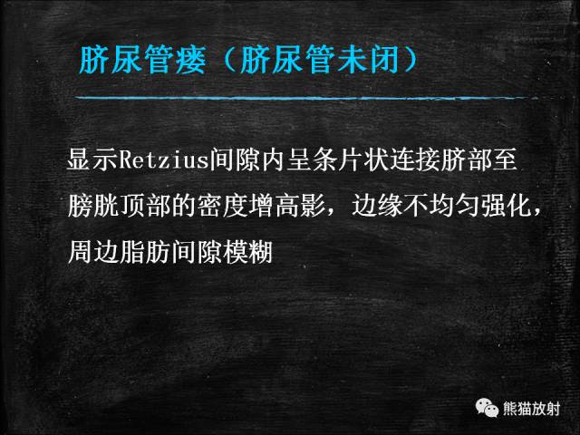 【PPT】脐尿管畸形与脐尿管癌的CT表现