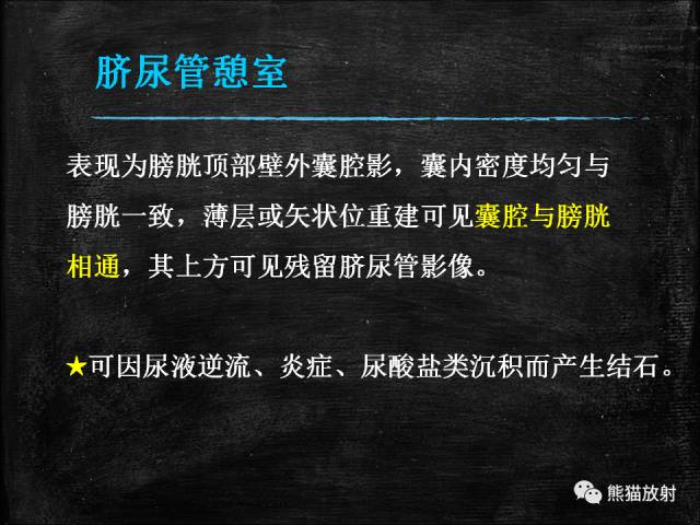 【PPT】脐尿管畸形与脐尿管癌的CT表现