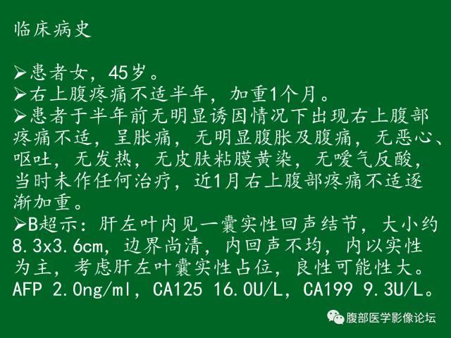 【病例】肝神经鞘瘤二例CT及MR