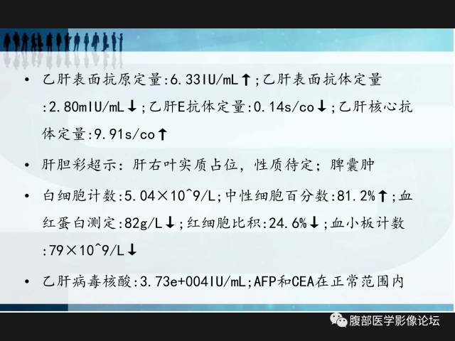 【病例】肝神经鞘瘤二例CT及MR 【病例】肝神经鞘瘤二例CT及MR