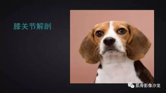 【PPT】膝关节解剖和半月板损伤影像解读