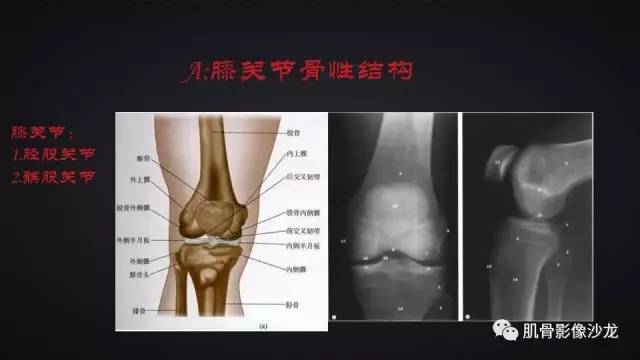 【PPT】膝关节解剖和半月板损伤影像解读