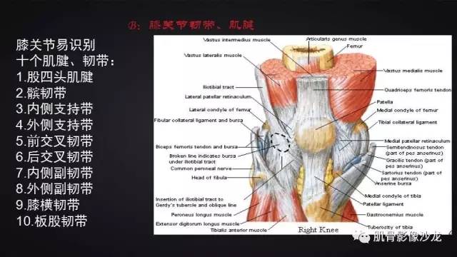 【PPT】膝关节解剖和半月板损伤影像解读