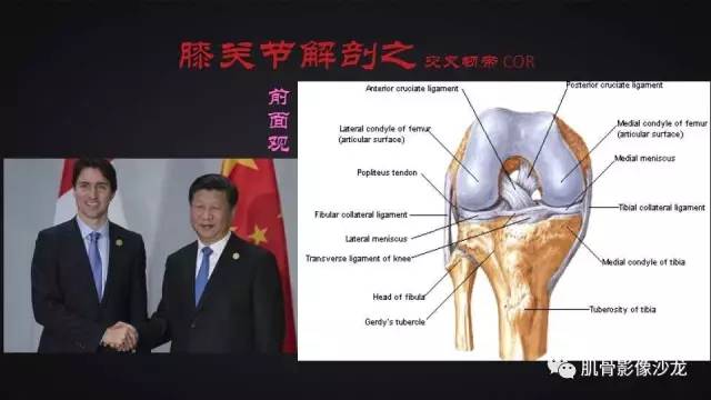【PPT】膝关节解剖和半月板损伤影像解读