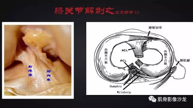 【PPT】膝关节解剖和半月板损伤影像解读