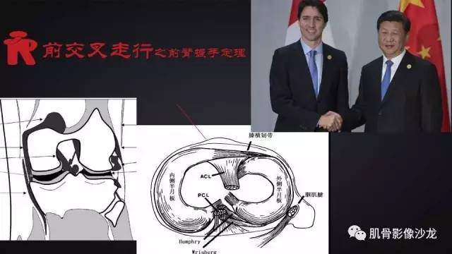 【PPT】膝关节解剖和半月板损伤影像解读