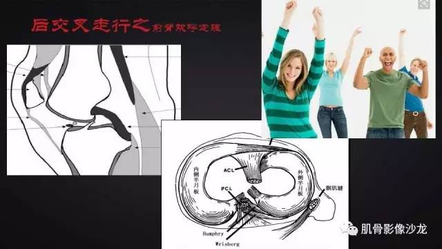 【PPT】膝关节解剖和半月板损伤影像解读