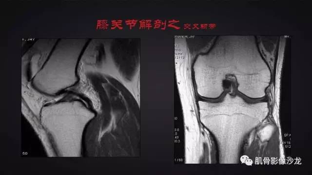 【PPT】膝关节解剖和半月板损伤影像解读