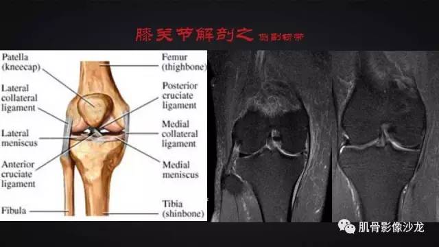 【PPT】膝关节解剖和半月板损伤影像解读