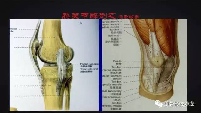 【PPT】膝关节解剖和半月板损伤影像解读