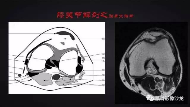 【PPT】膝关节解剖和半月板损伤影像解读