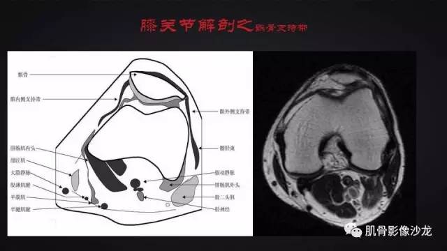 【PPT】膝关节解剖和半月板损伤影像解读