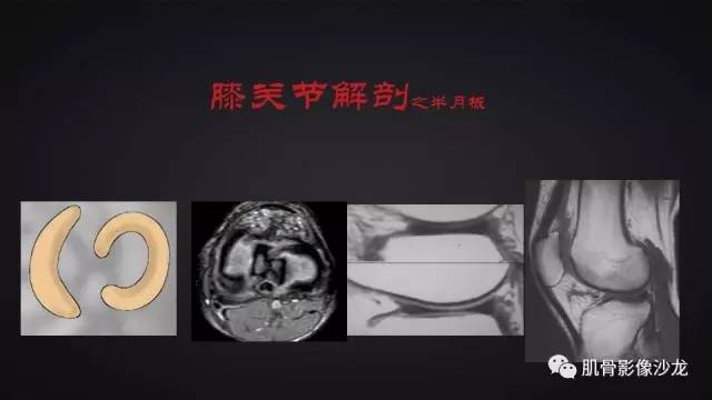 【PPT】膝关节解剖和半月板损伤影像解读