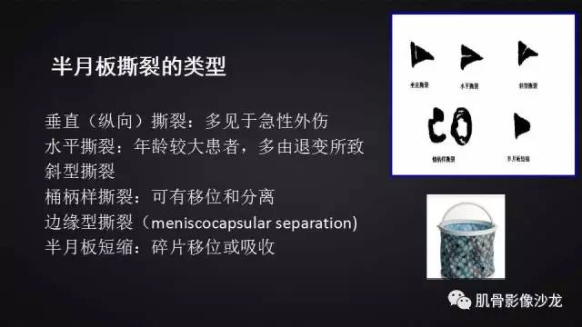【PPT】膝关节解剖和半月板损伤影像解读