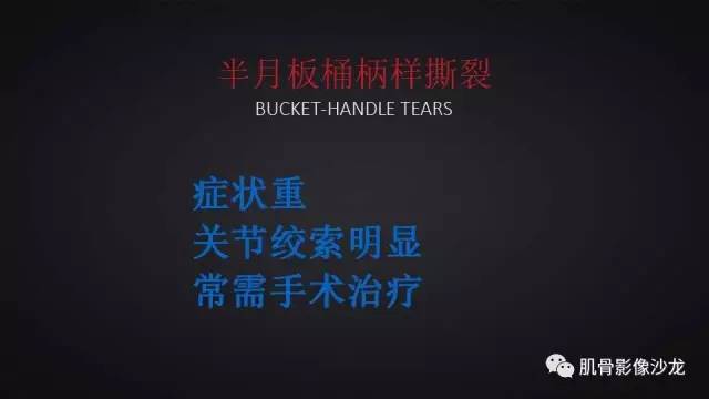 【PPT】膝关节解剖和半月板损伤影像解读
