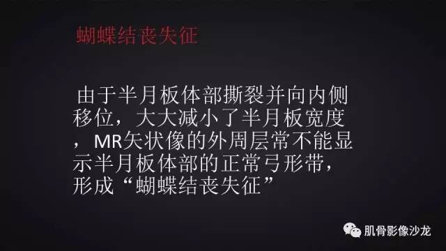 【PPT】膝关节解剖和半月板损伤影像解读